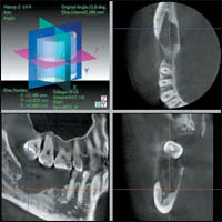 Стоматологический компьютерный томограф 3 DX Accuitomo / FPD —диагностика XXI века