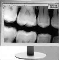 Радиовизиографы Kodak Dental Systems: диагностическое оборудование будущего