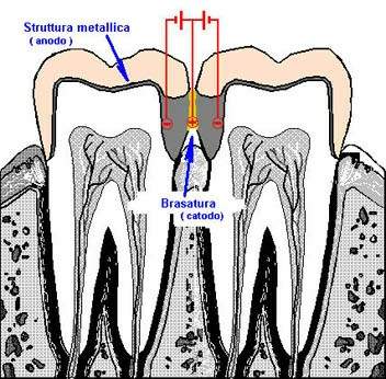 Имплантанты, лазер и титан: триумвират современной стоматологии