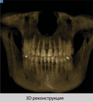 Опыт использования стоматологического томографа NewTom 3G в условиях обработки большого потока пациентов
